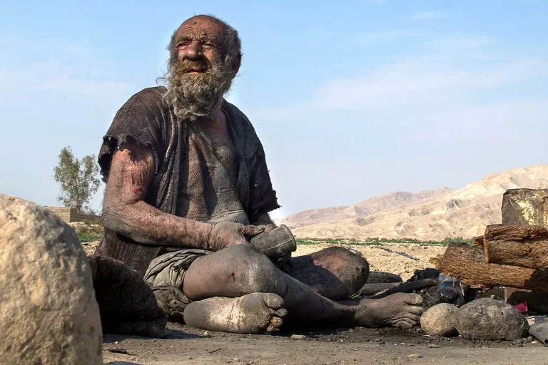 Amou Haji, Known as ‘World’s Dirtiest Man,’ Dead at 94 ‘Not Long After’ First Bath in 60 Years